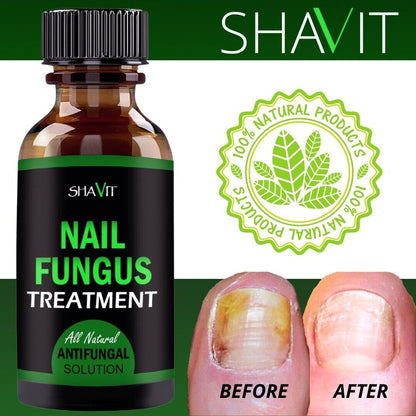 Toenail And Fingernail Fungus Treatment Extra Strength Antifungal Athletes Foot